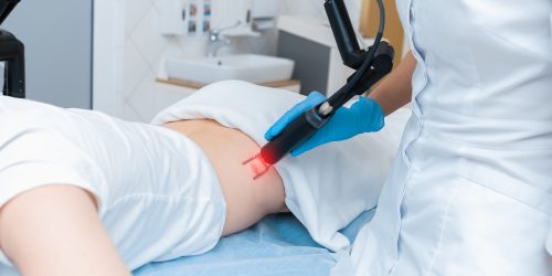 Laser hardware removal of a scar in modern cosmetology.